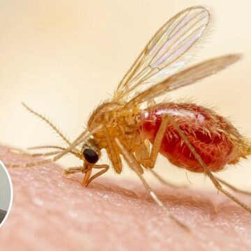 747723642_1012852451351654_1754399907226034441_n Confirman caso de leishmaniasis visceral en un menor de 5 años